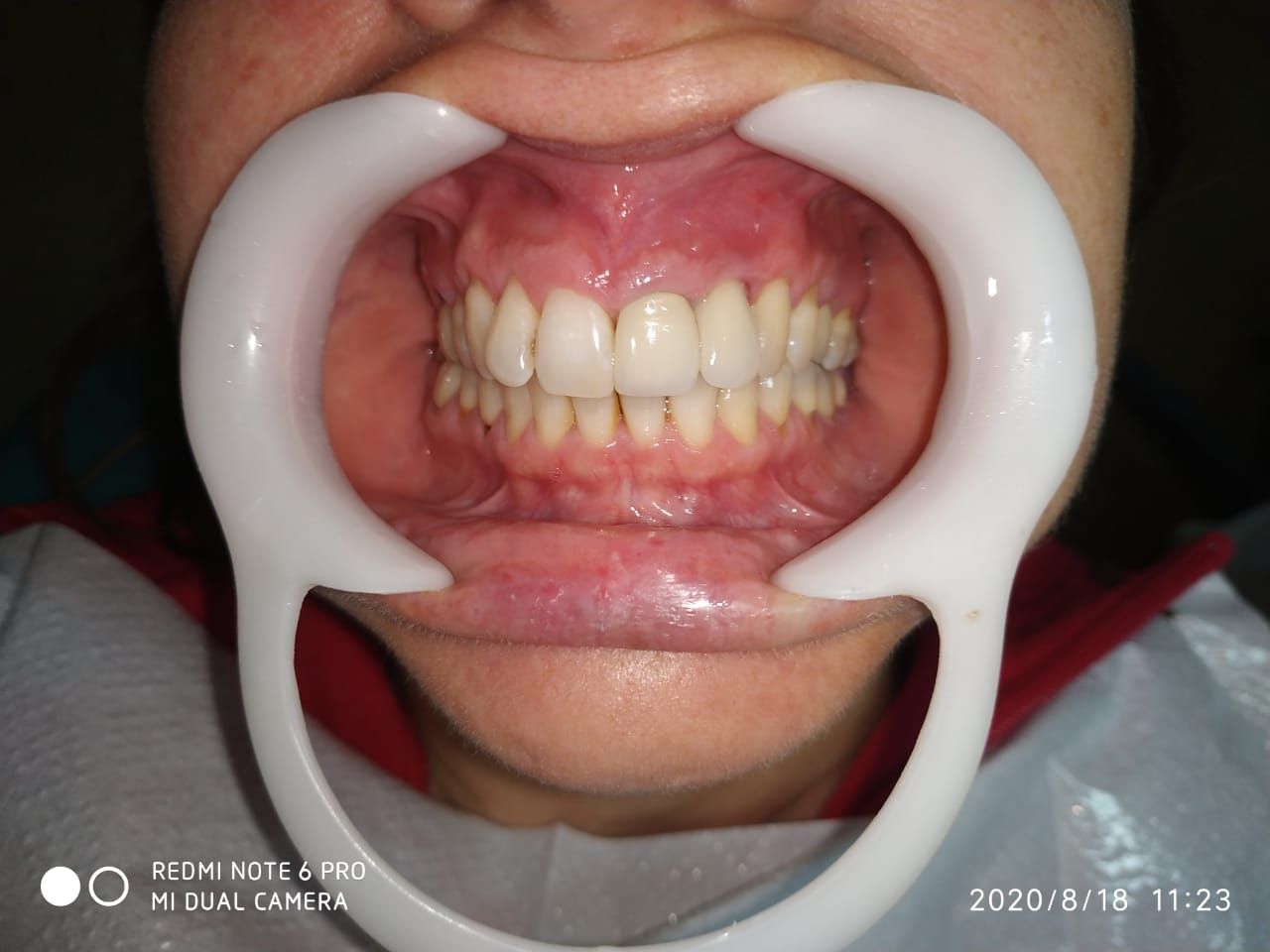 Pablo B. Azcárate-10