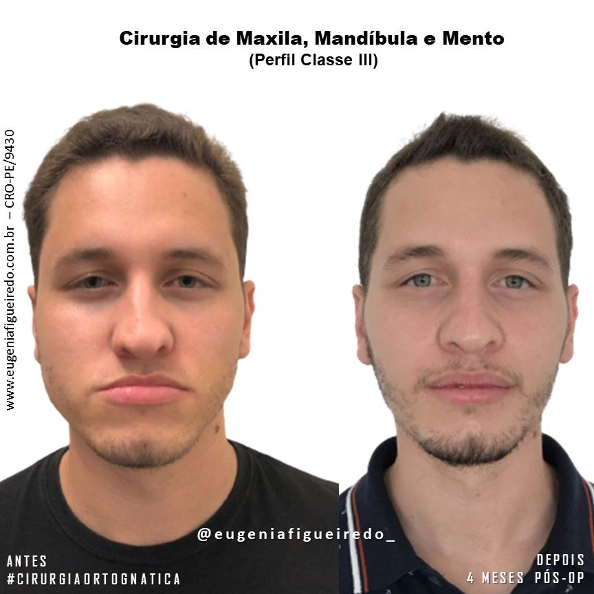 Eugênia Figueiredo-16