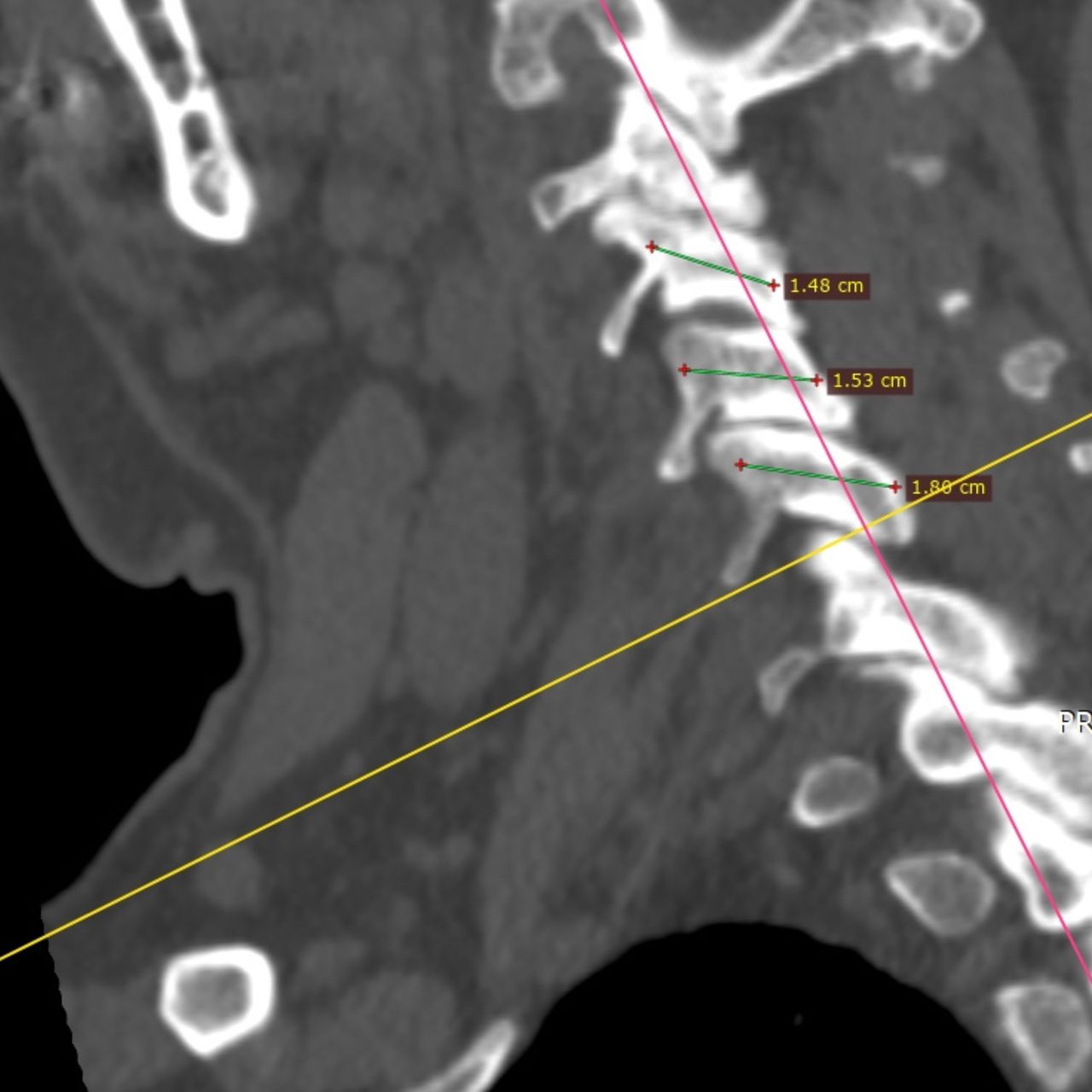 David Tafur Muñoz-1481