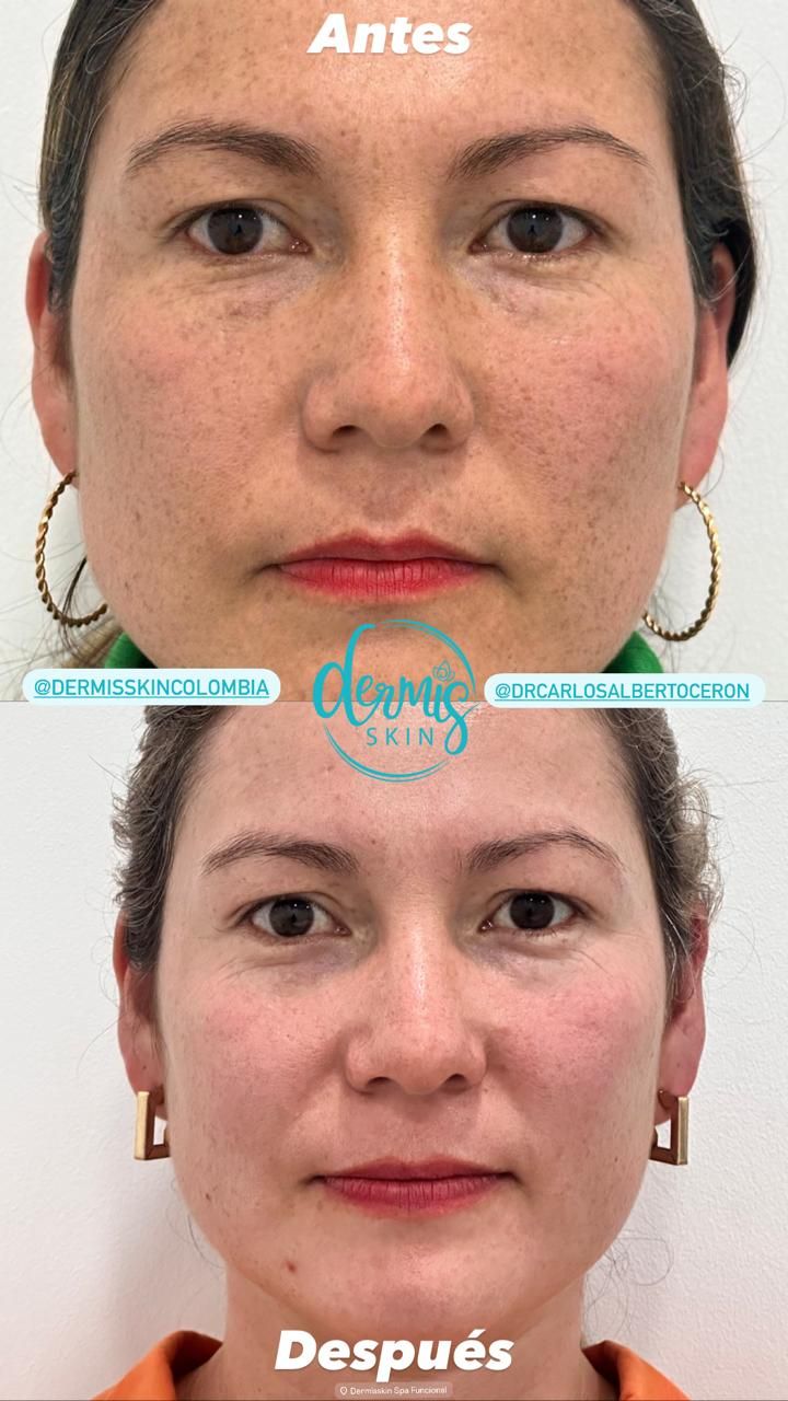 Carlos Alberto Ceron Gomez-2