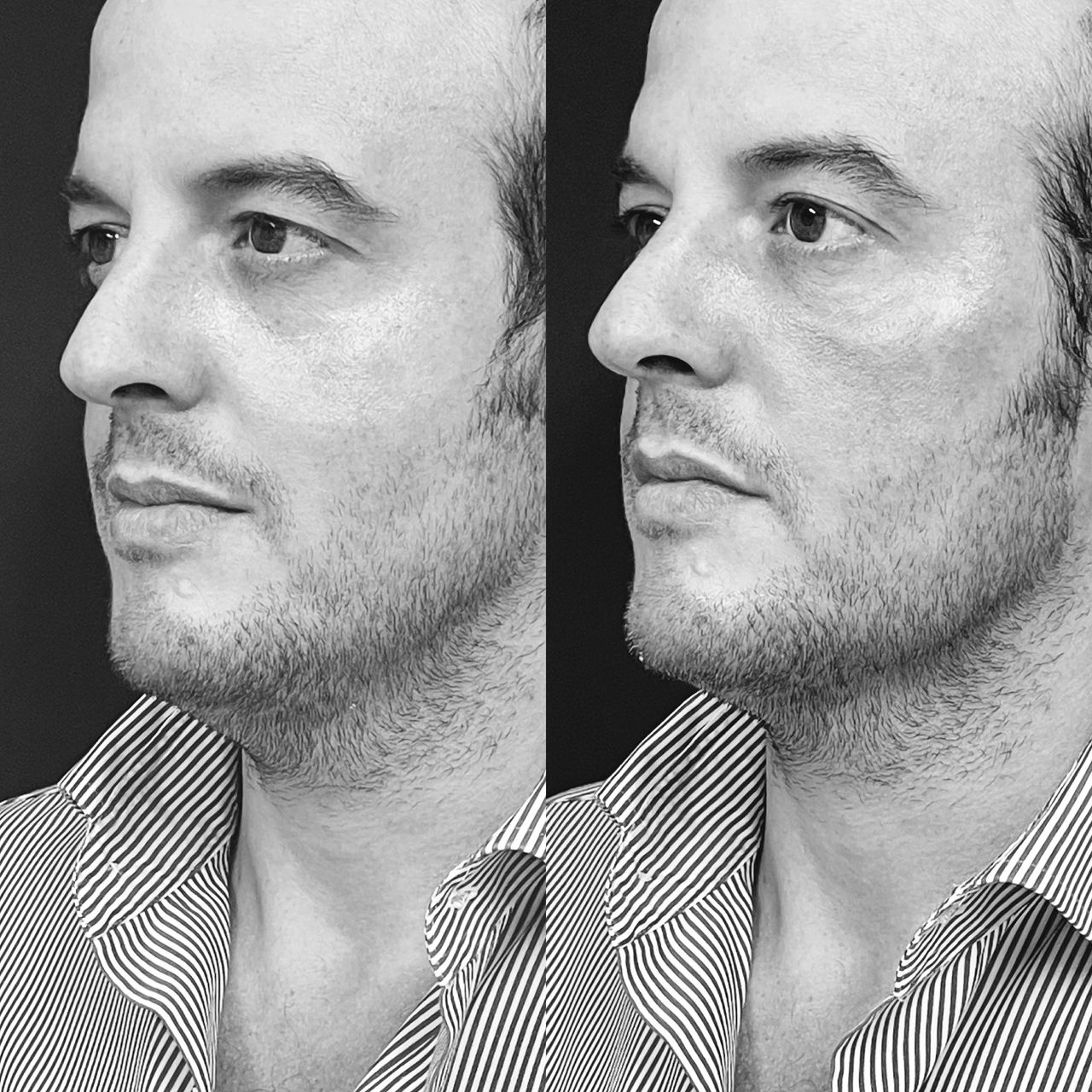 Gisele De Carvalho Versannio-23