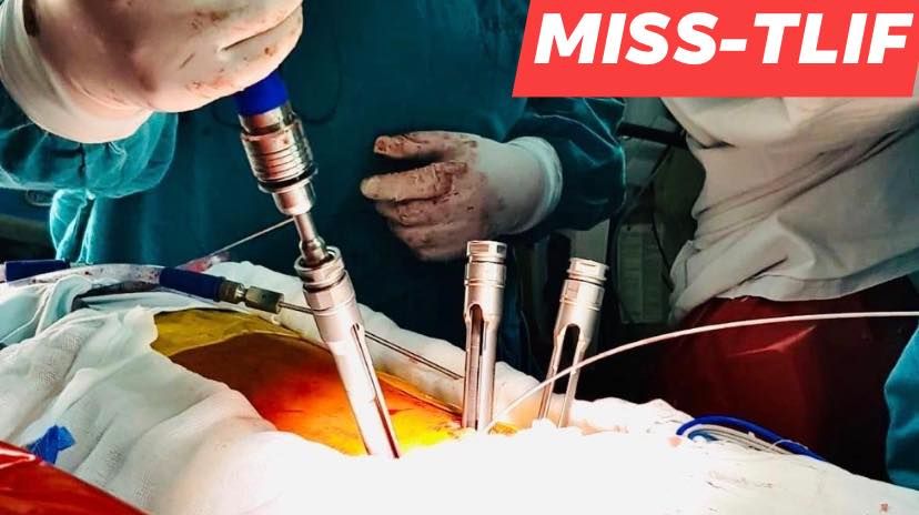 Vladimir Sánchez Ochoa-22