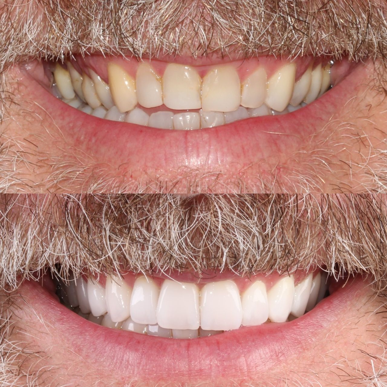 Caroline Benedeti-27