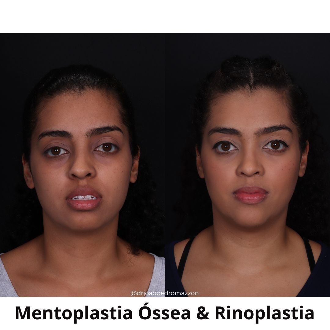 João Pedro Paulino Mazzon-18