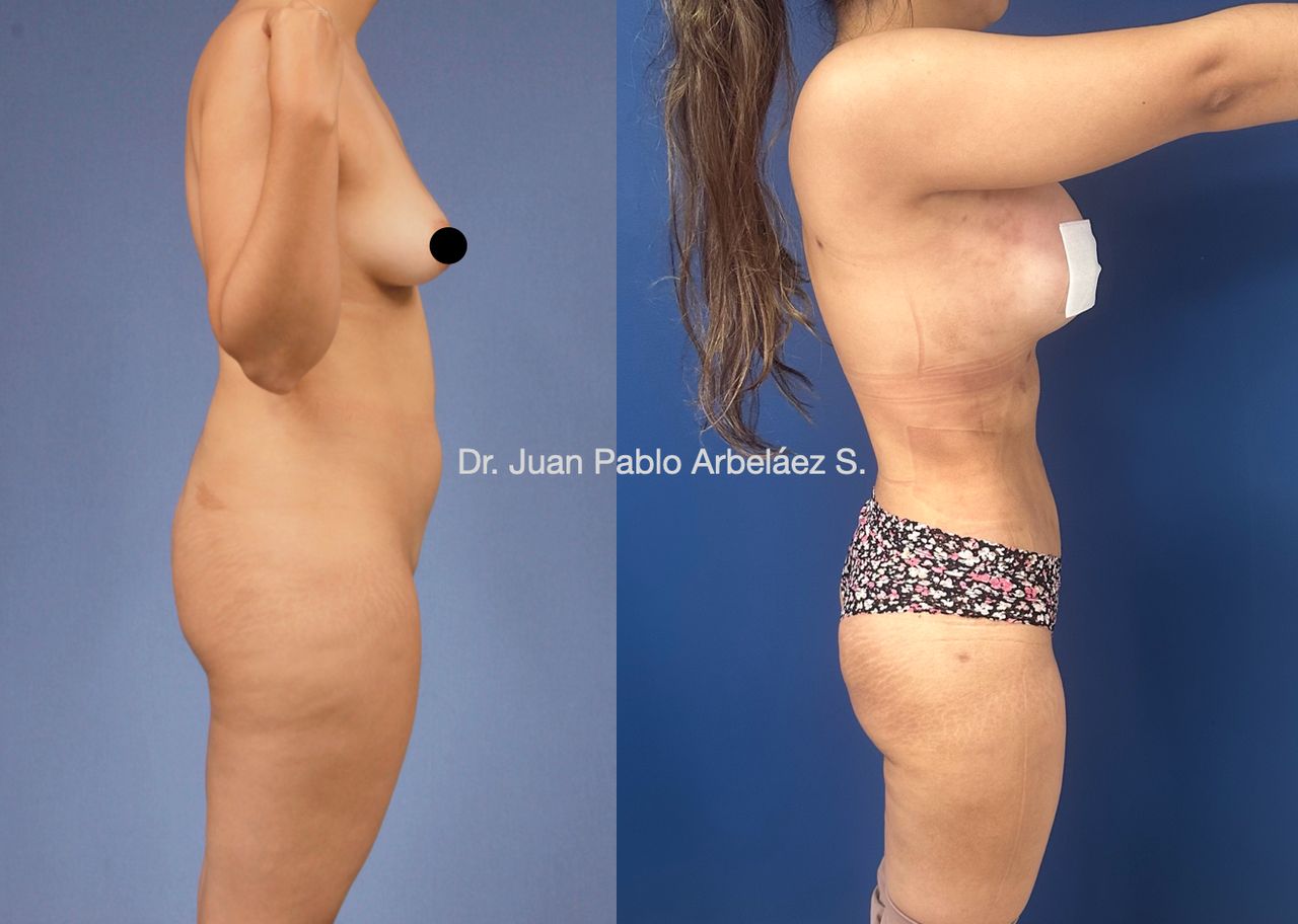 Juan Pablo Arbeláez Sierra-12