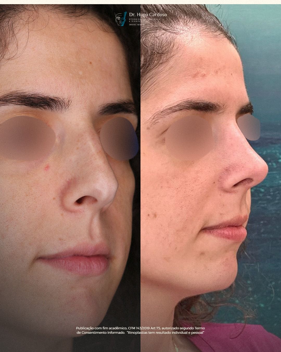 Hugo Cardoso De Oliveira-13