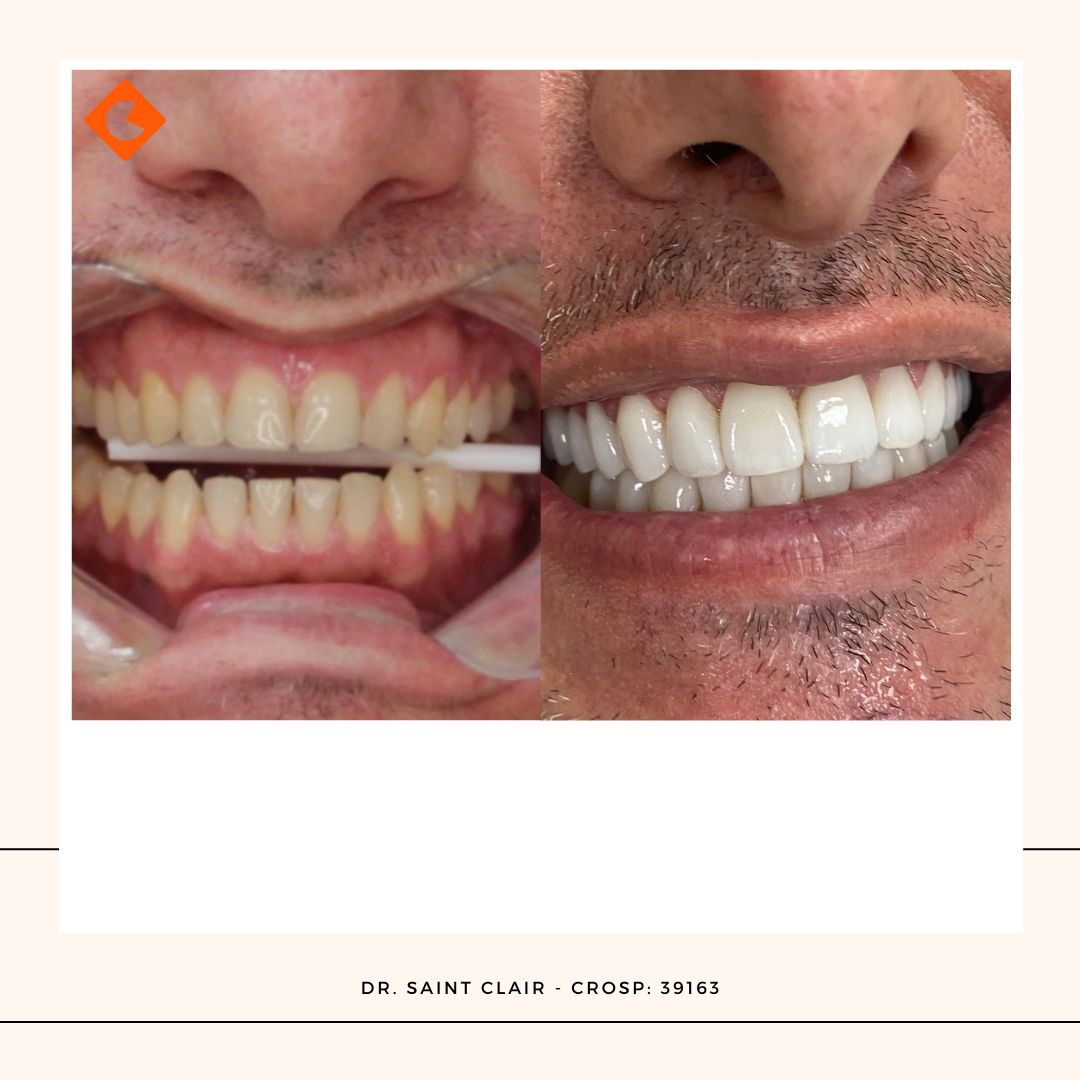 Saint Clair Barbosa Netto-21