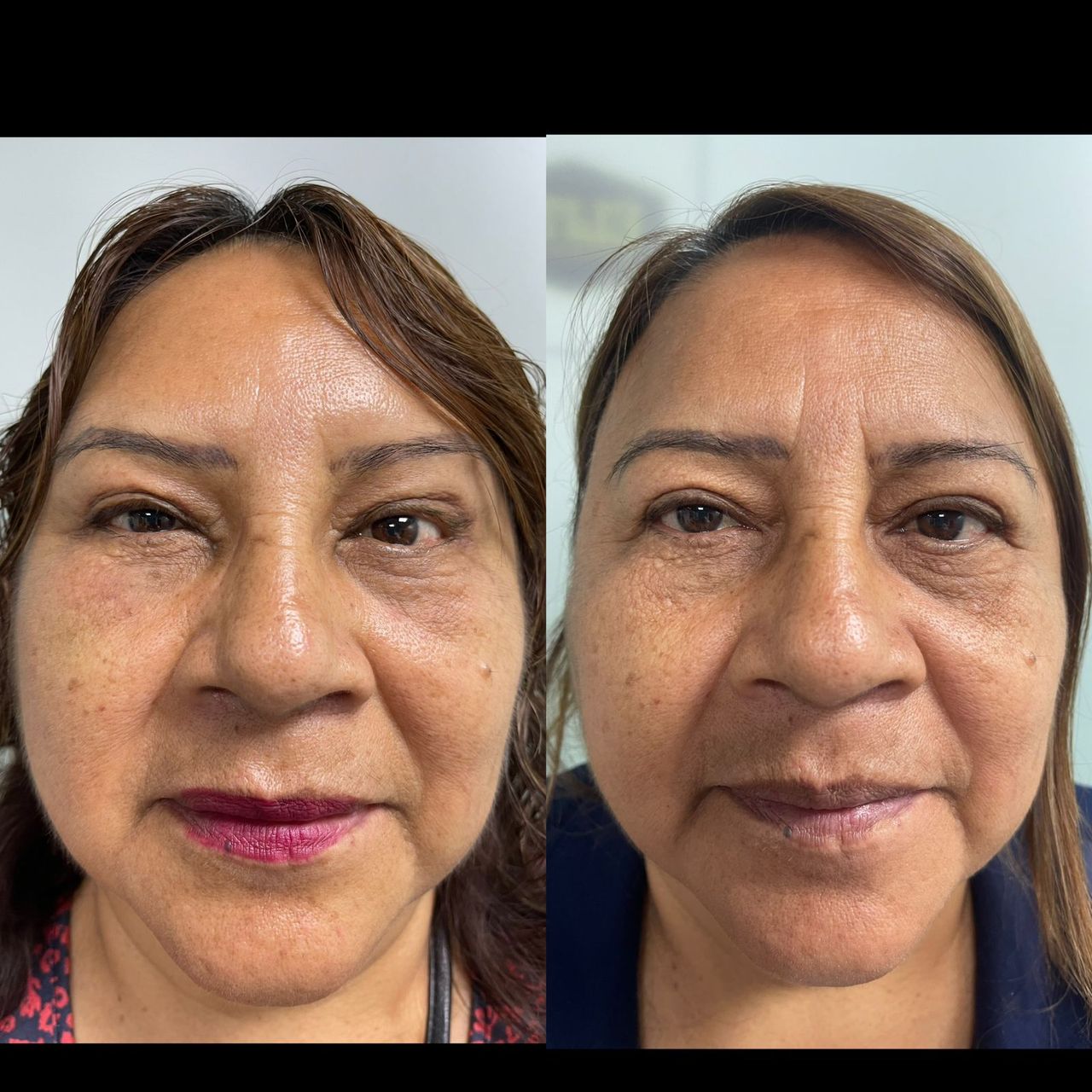 Roberto Alexander Rodriguez Zuñiga-9