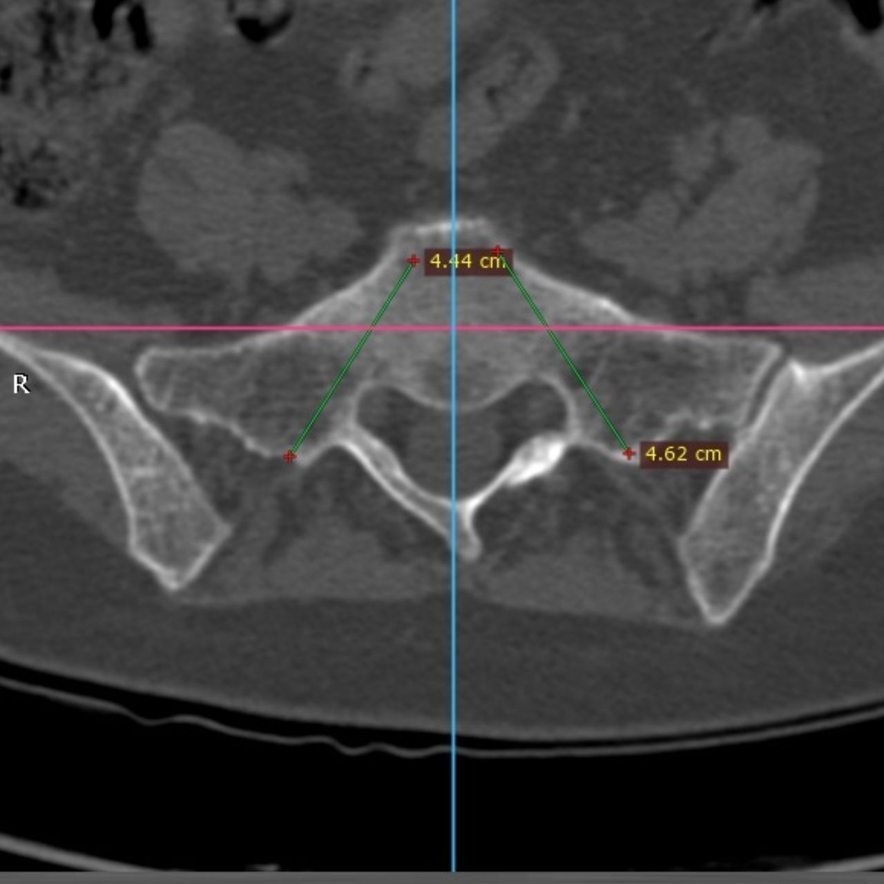 David Tafur Muñoz-1525