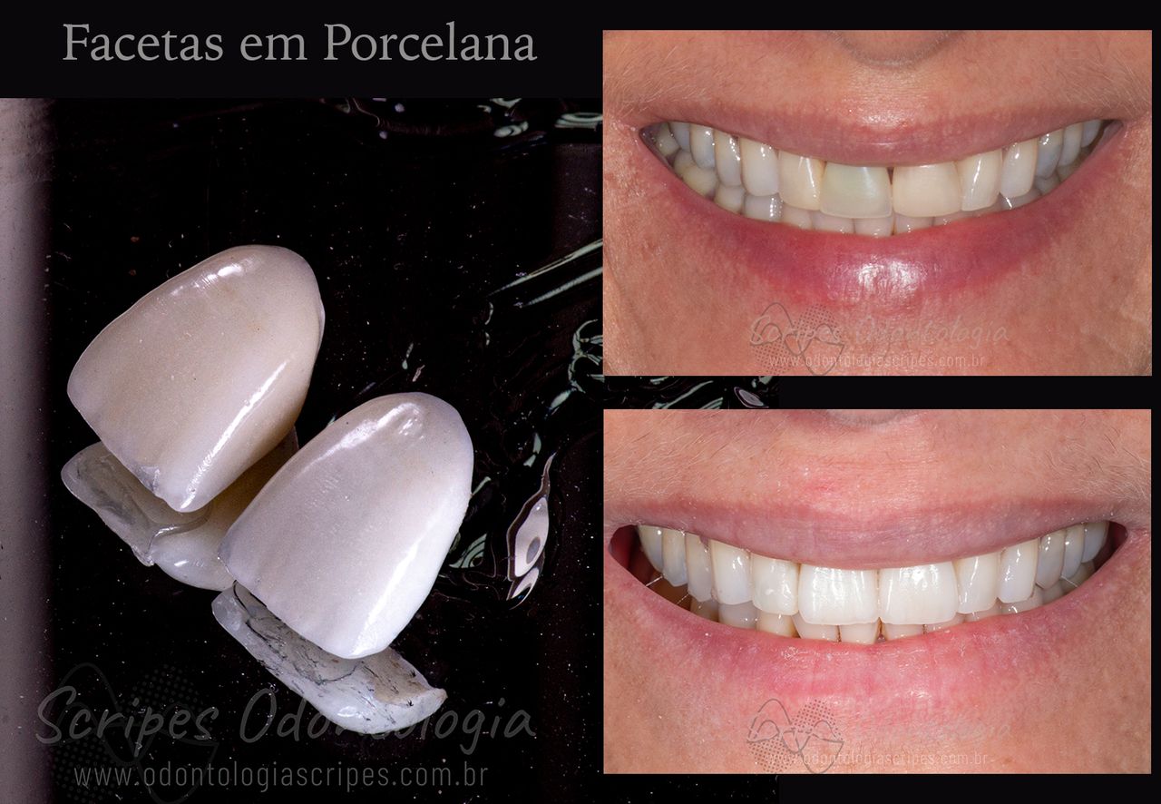 Gabriel Godoy Scripes-75