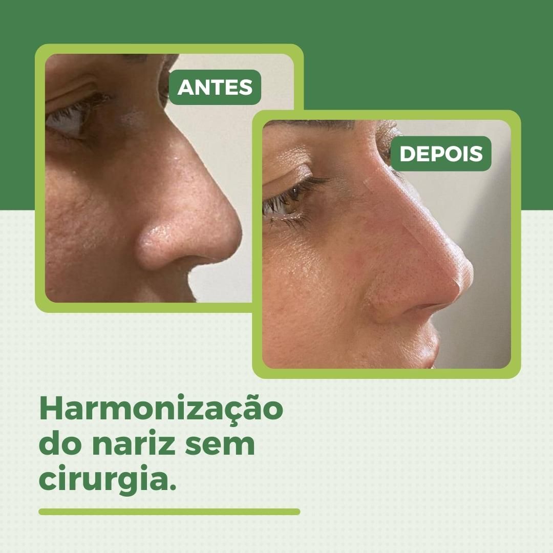 Luiz Antonio Da Silva-19