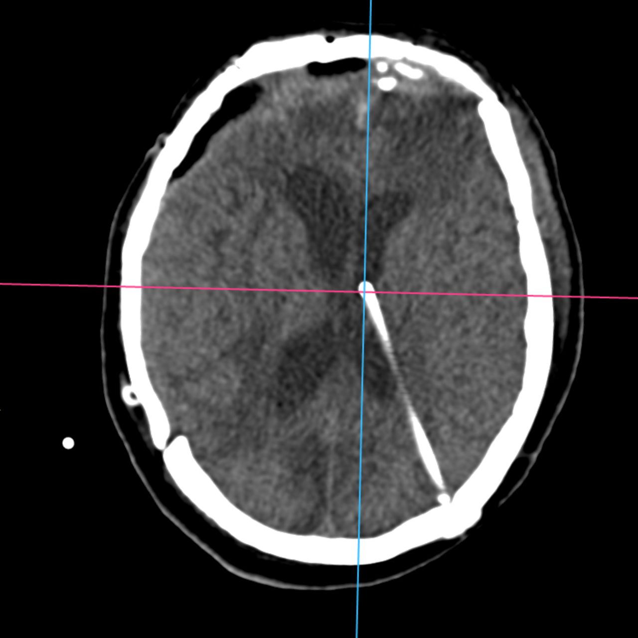 David Tafur Muñoz-2097