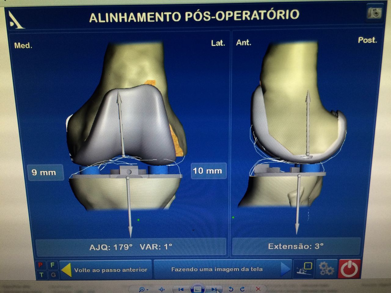 Darci Duarte Lopes Junior-10