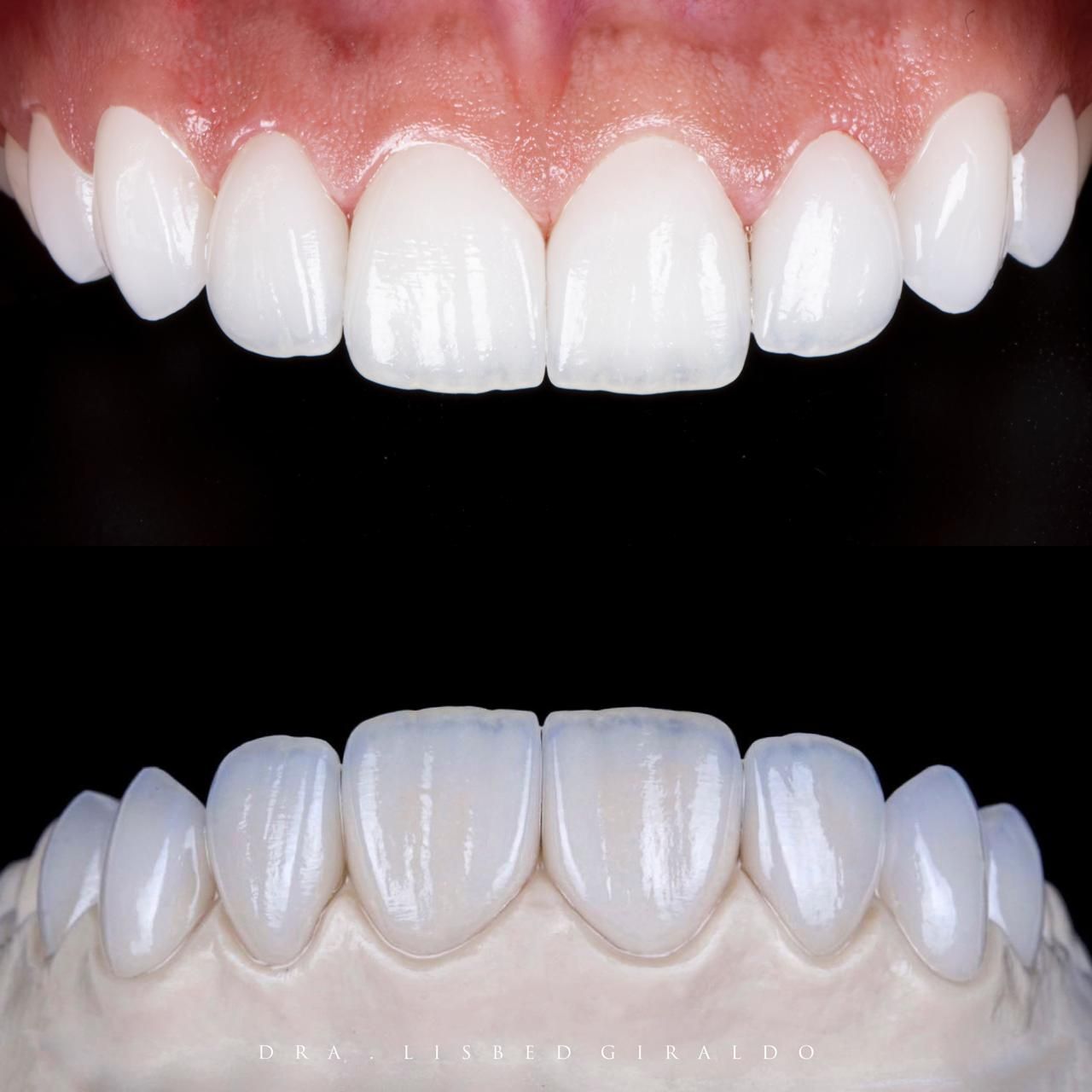 Lisbed Giraldo Olarte-41