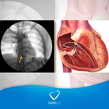 Frederico Bartolazzi-17