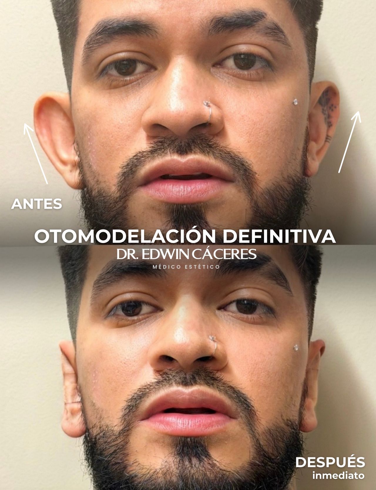 Edwin Cáceres Melendez-3