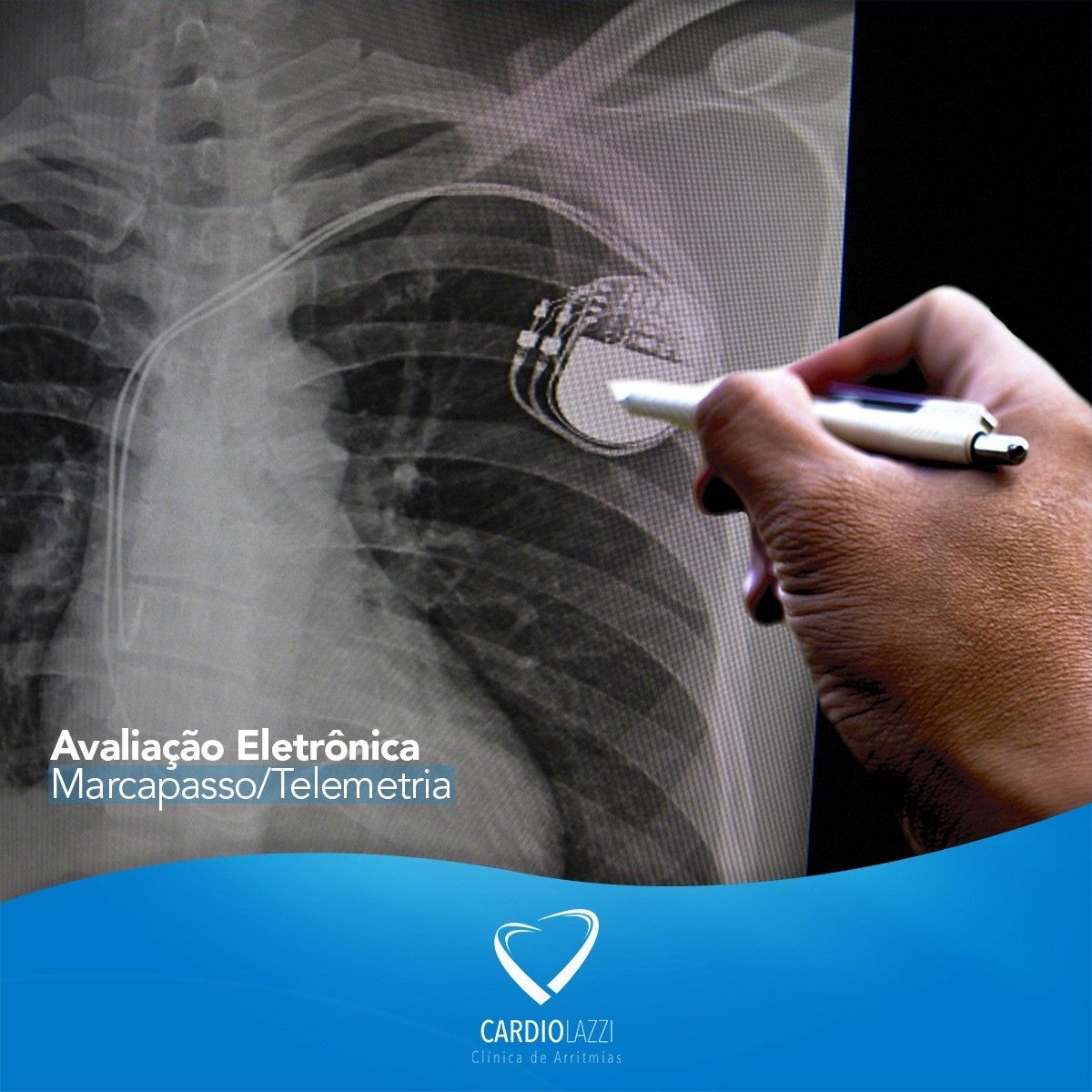 Frederico Bartolazzi-9