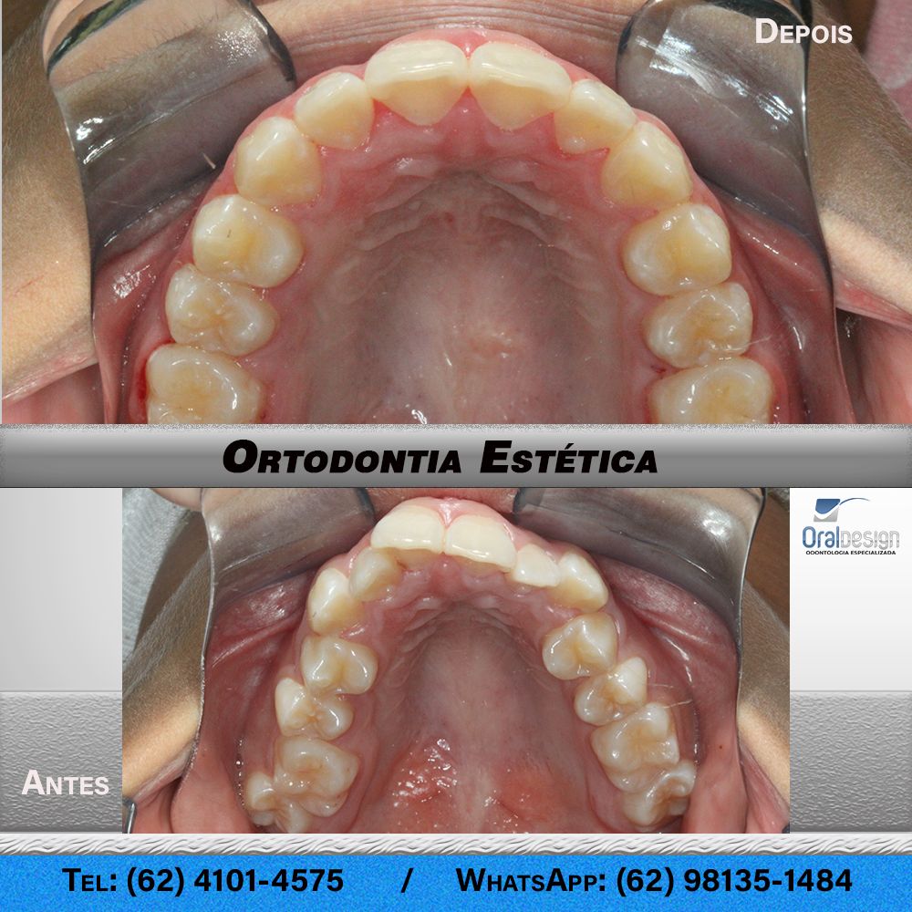 Danilo Monteiro Rezende Pereira-16