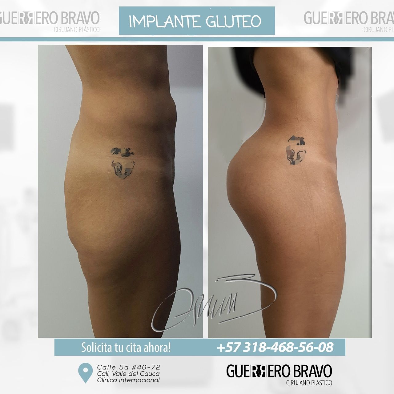 Camilo Guerrero Bravo-70