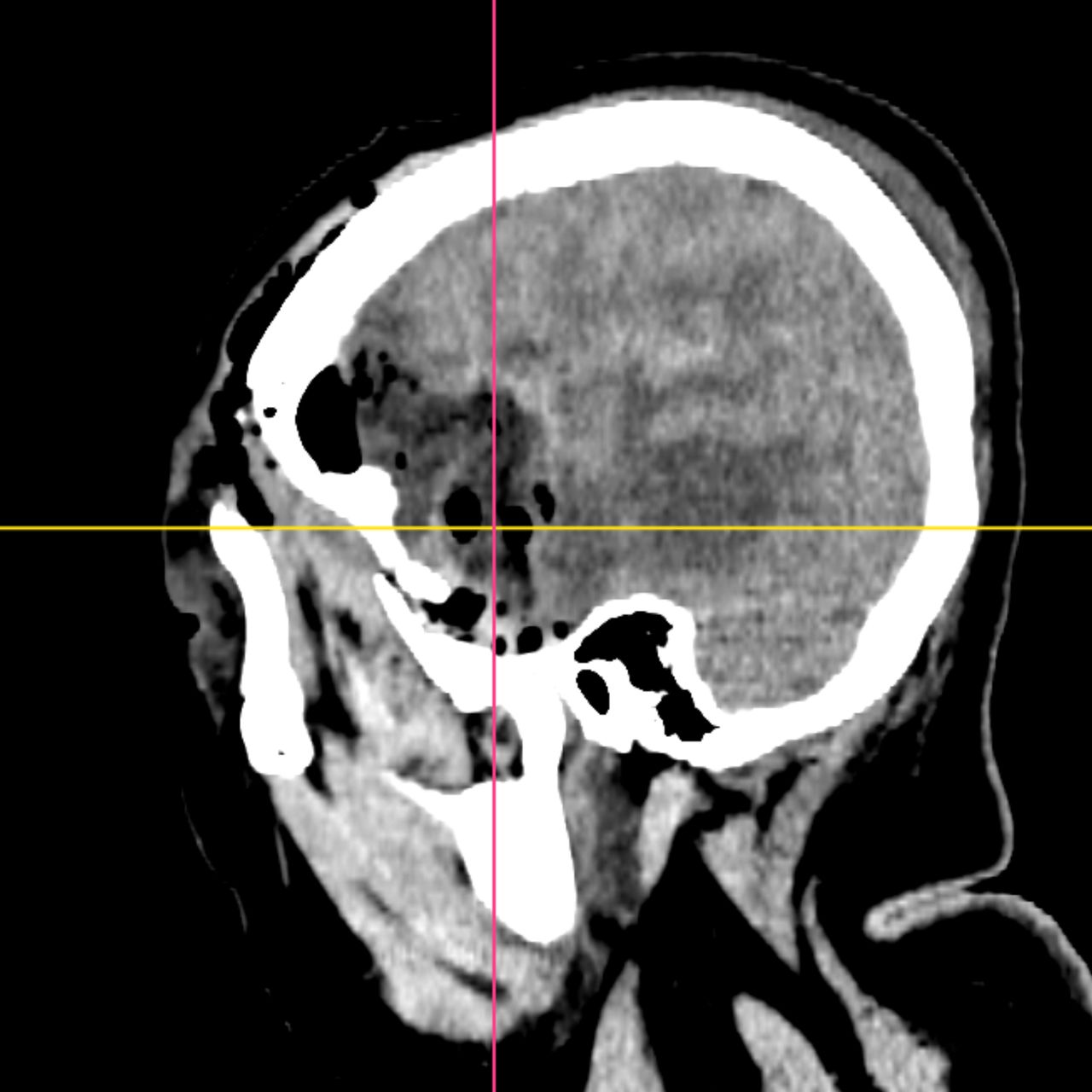 David Tafur Muñoz-2076