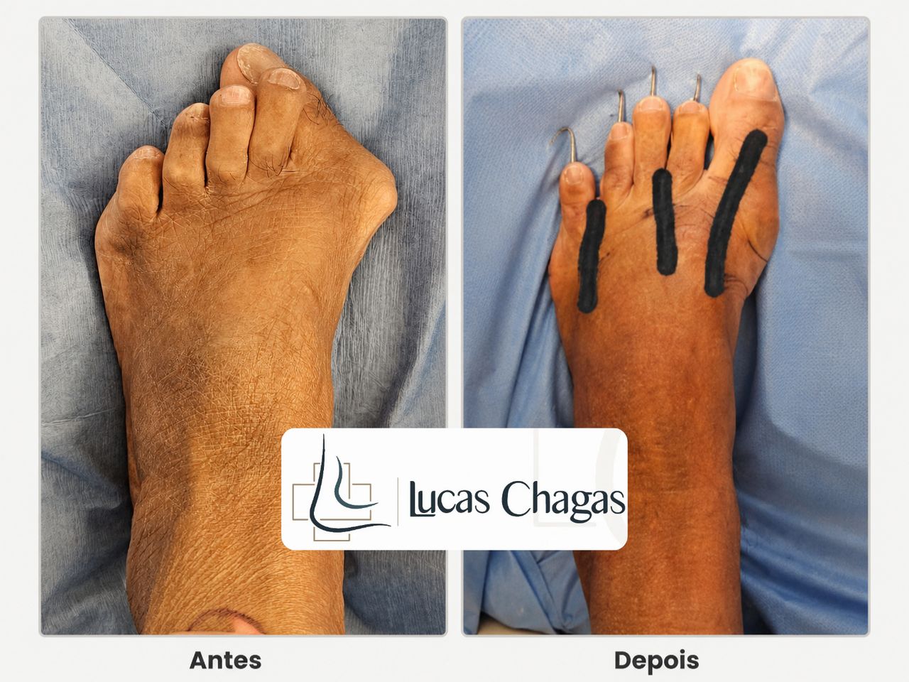 Lucas Chagas Gadelha-4