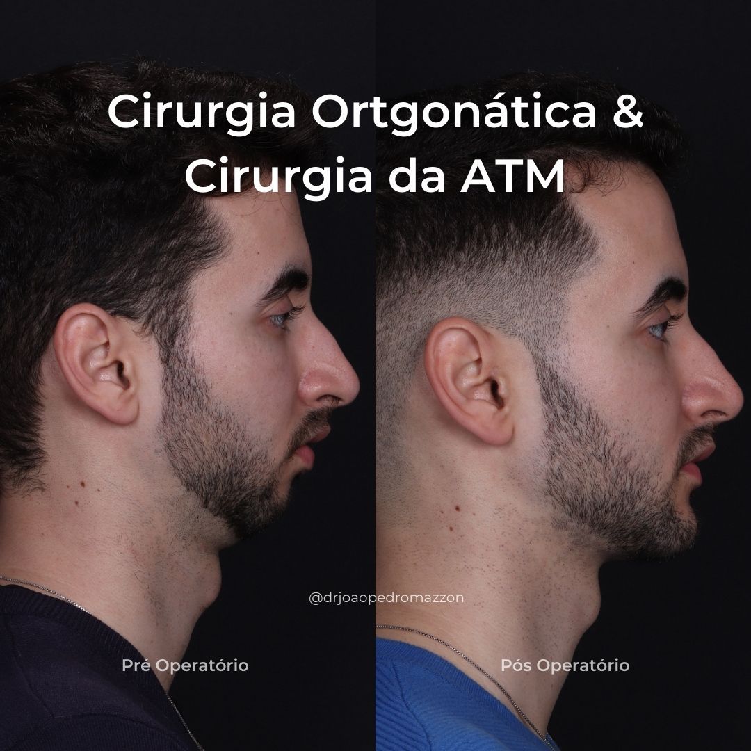 João Pedro Paulino Mazzon-72