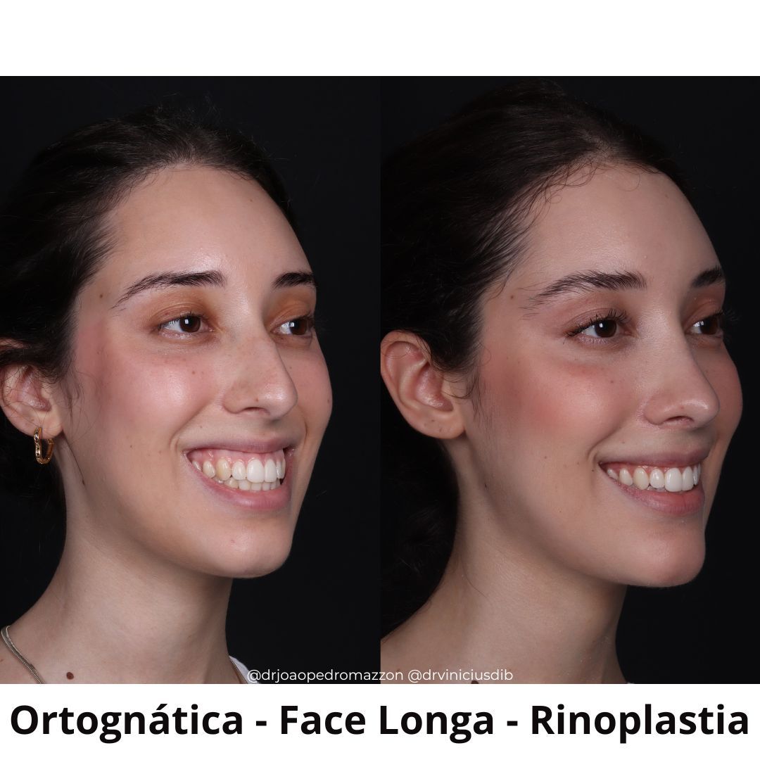 João Pedro Paulino Mazzon-10