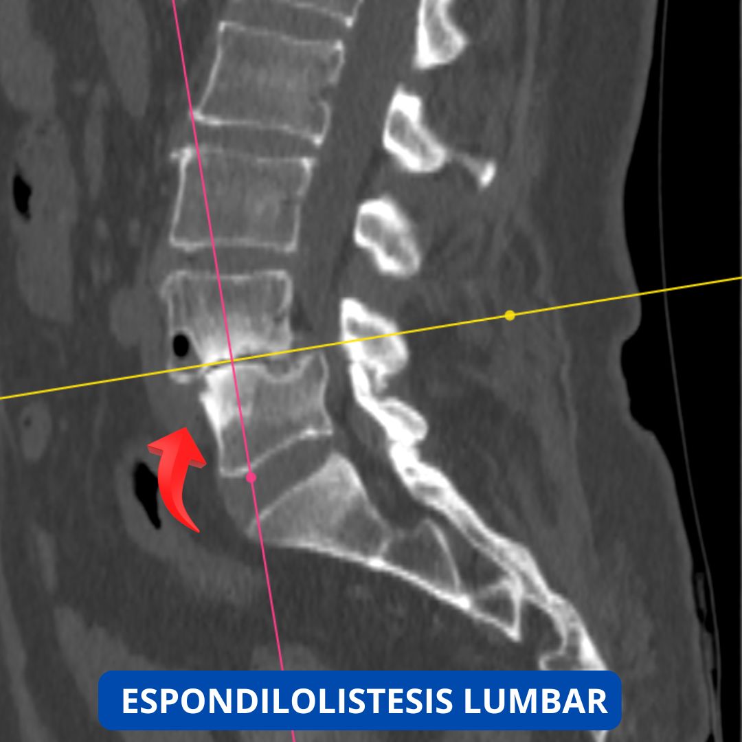 David Tafur Muñoz-2317