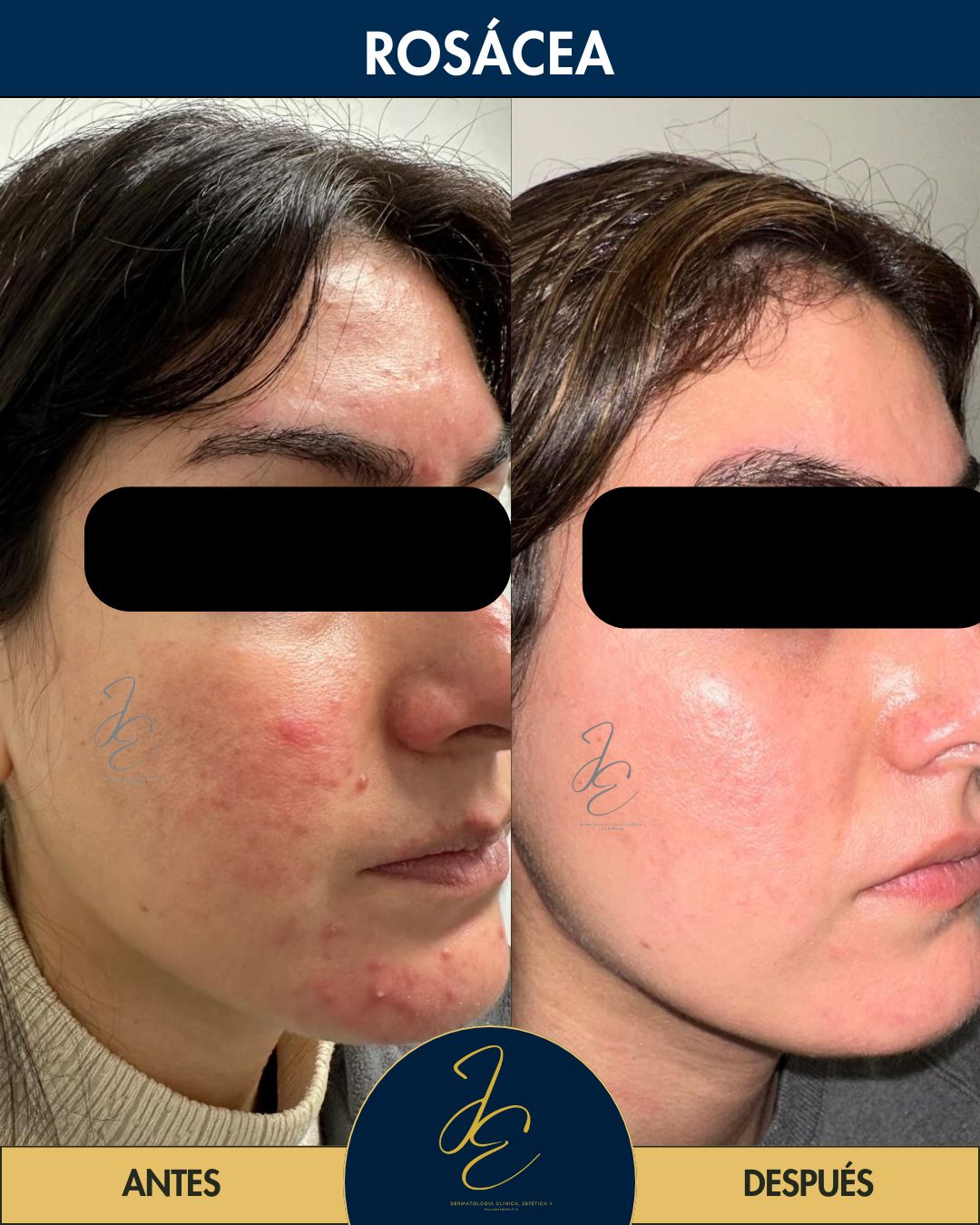 Jeanny Epieyu Diaz-12