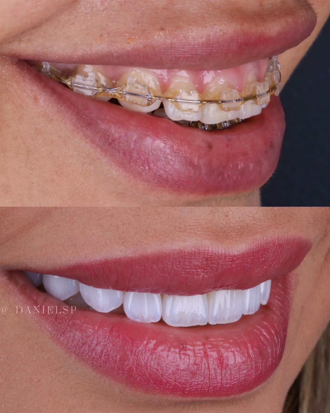 Daniel De Souza Pereira-35