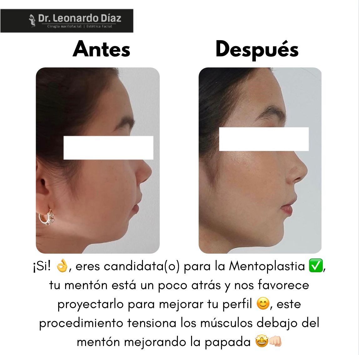 Leonardo Diaz Martínez-9