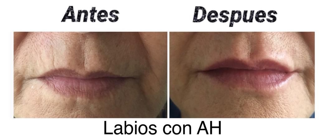 Maria Gisela Angel Losada-55