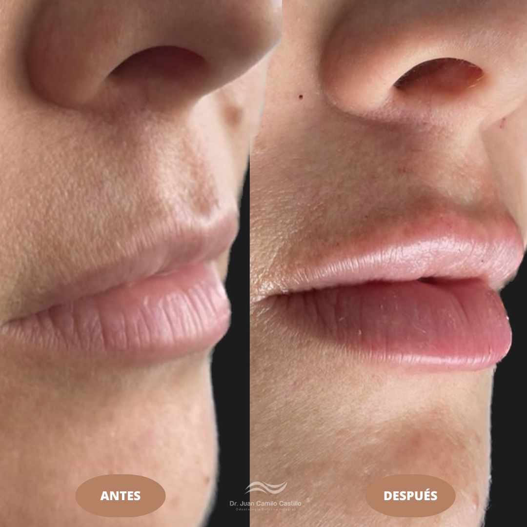 Juan Camilo Castillo-26