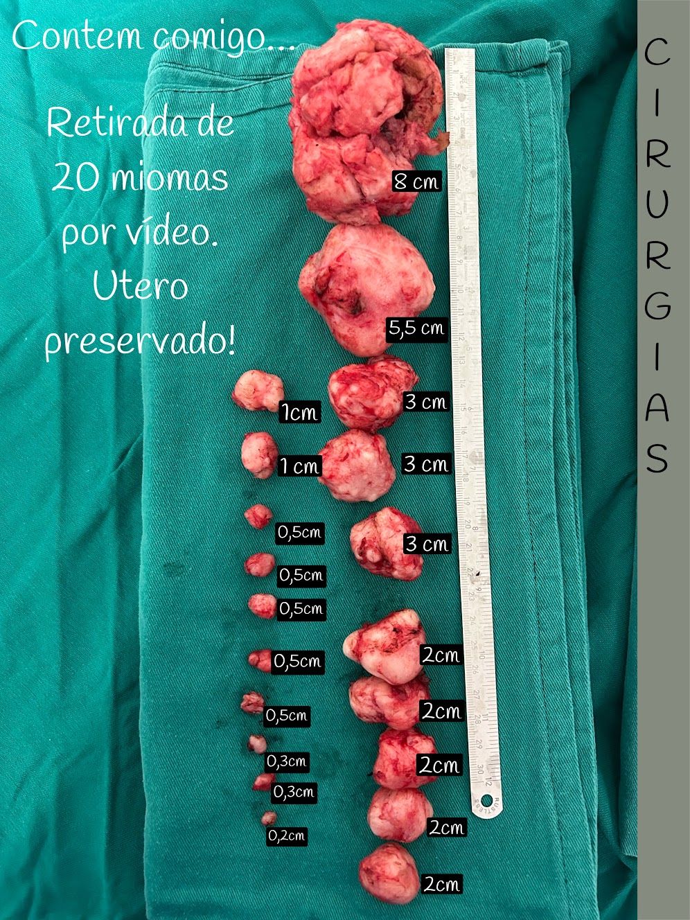 Adalberto Cesario Pereira Junior-51