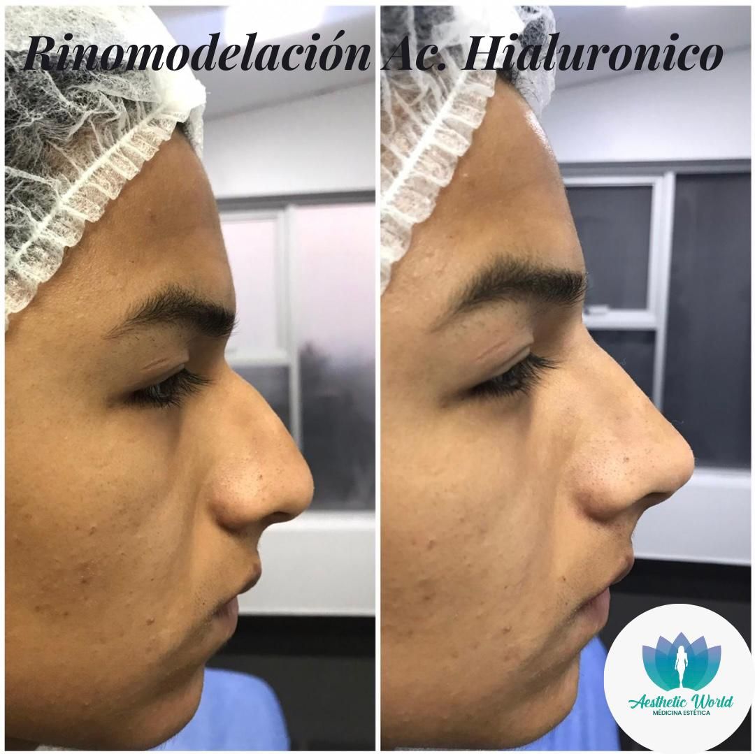 Jhonatan Oyola Farfán-25