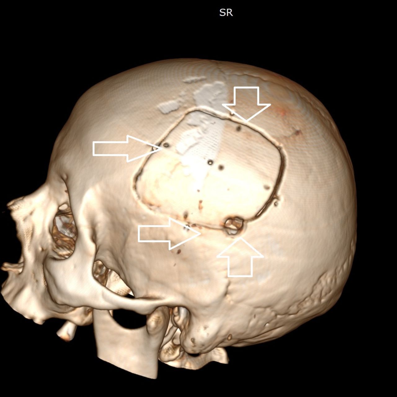 David Tafur Muñoz-1231