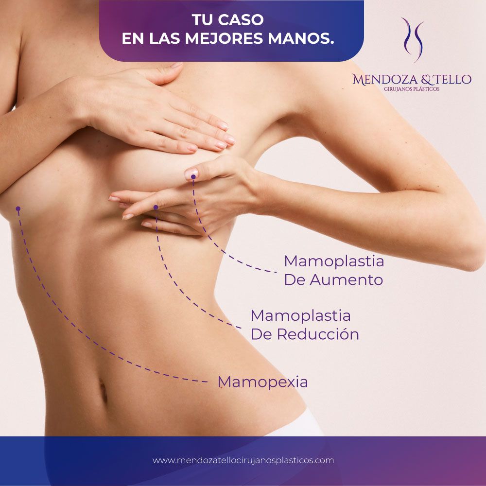 Liliana Tello Quijano-44