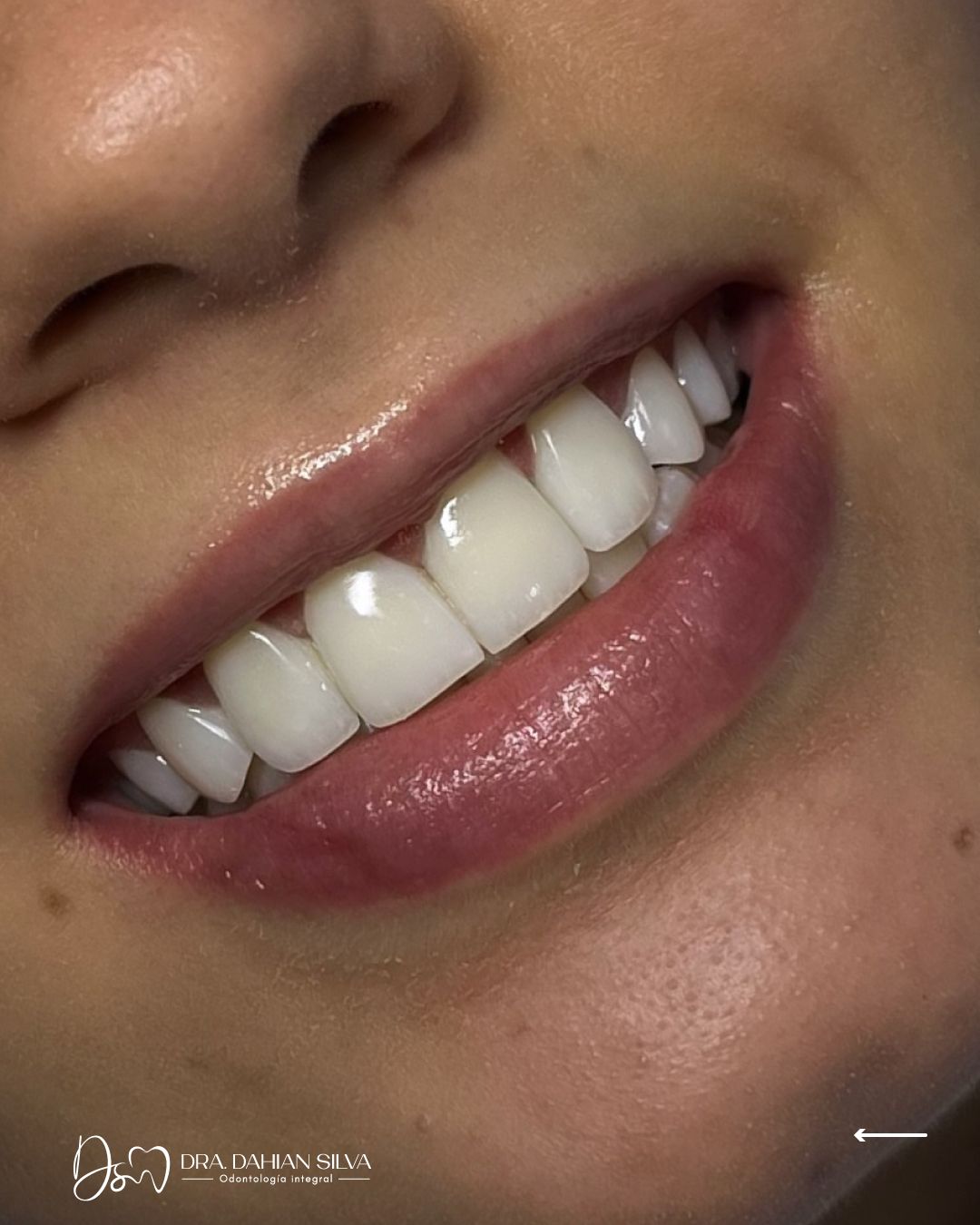 Dahian Lized Silva Polania-1