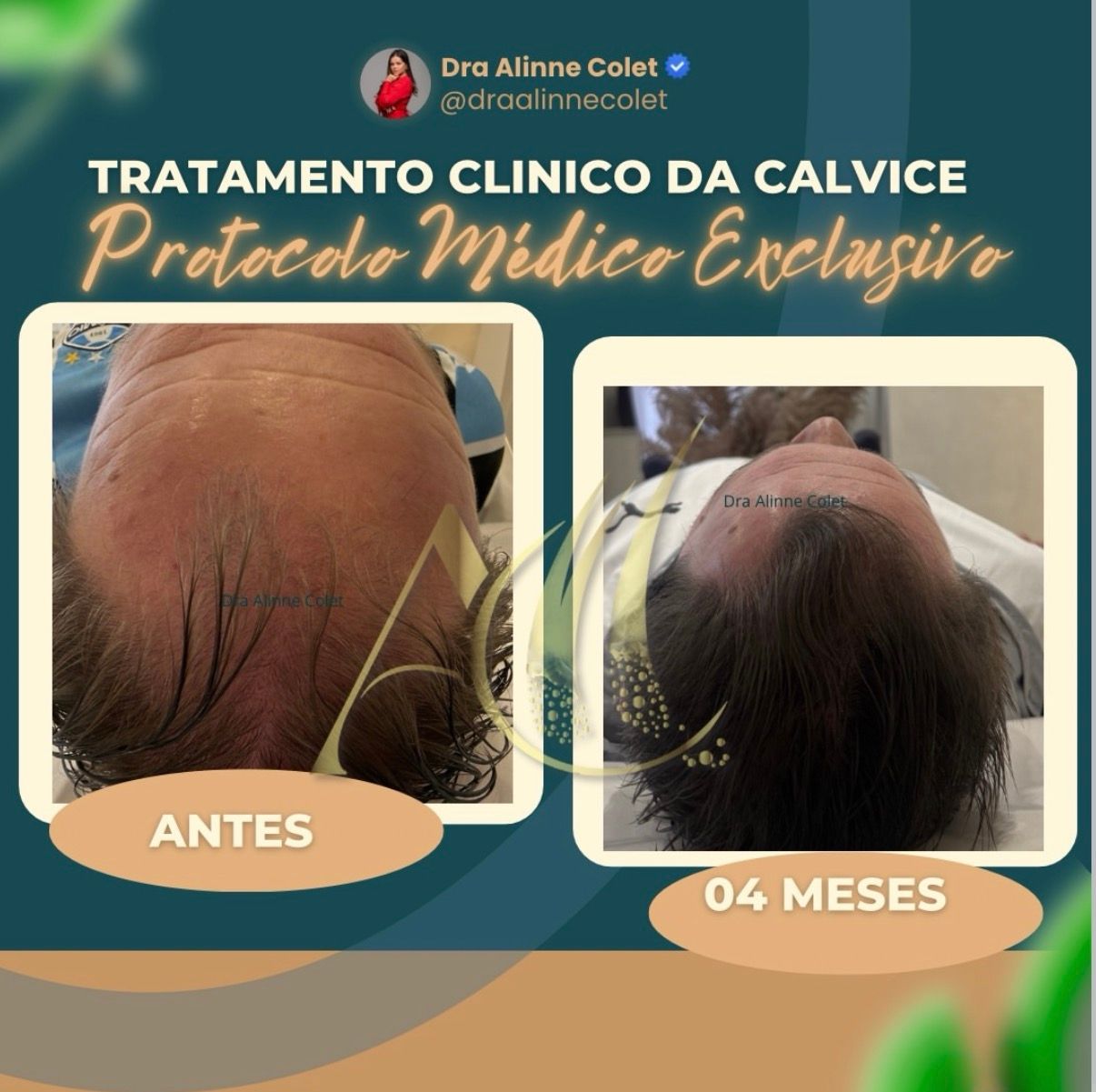 Alinne Gerssica Soares Colet-11