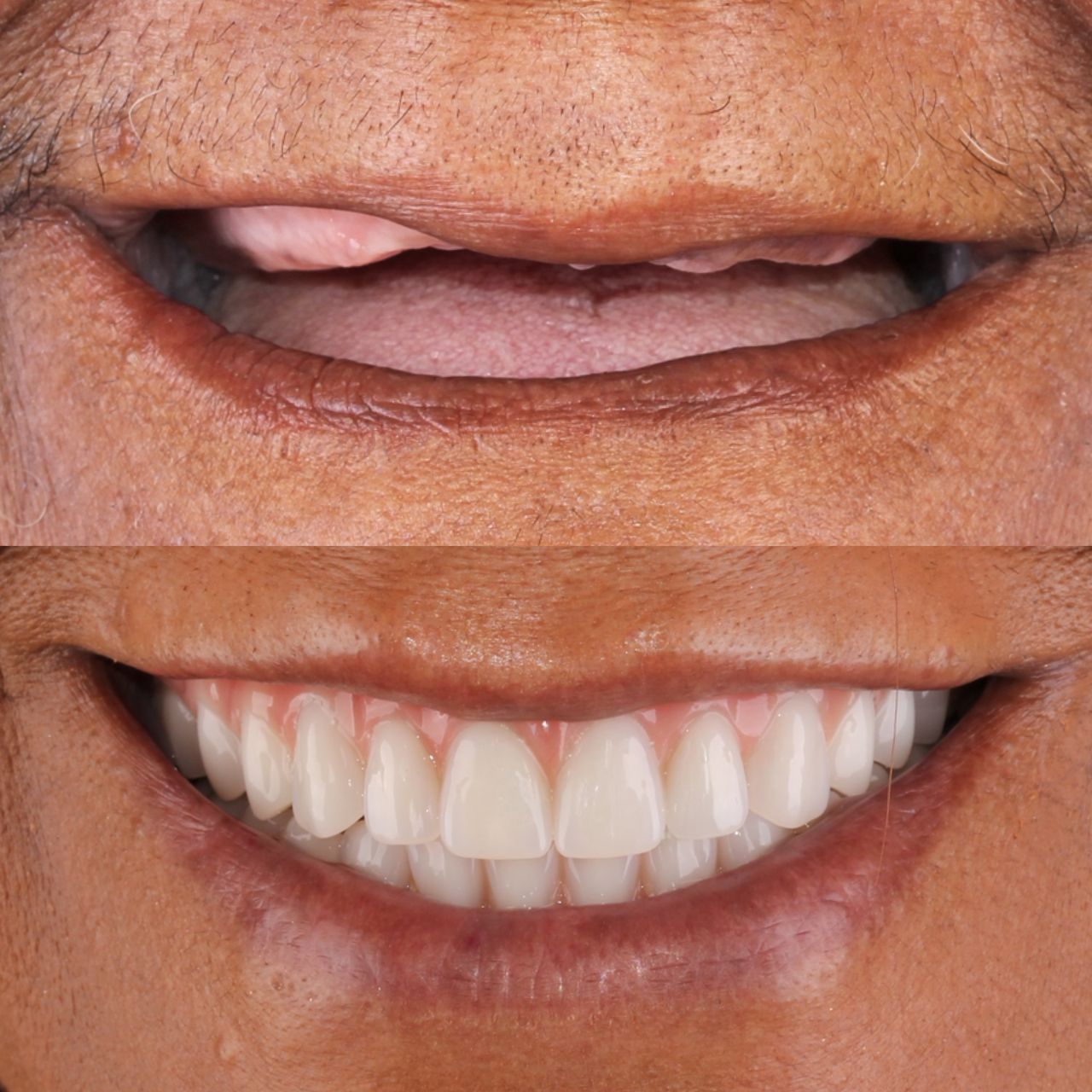 Caroline Benedeti-52