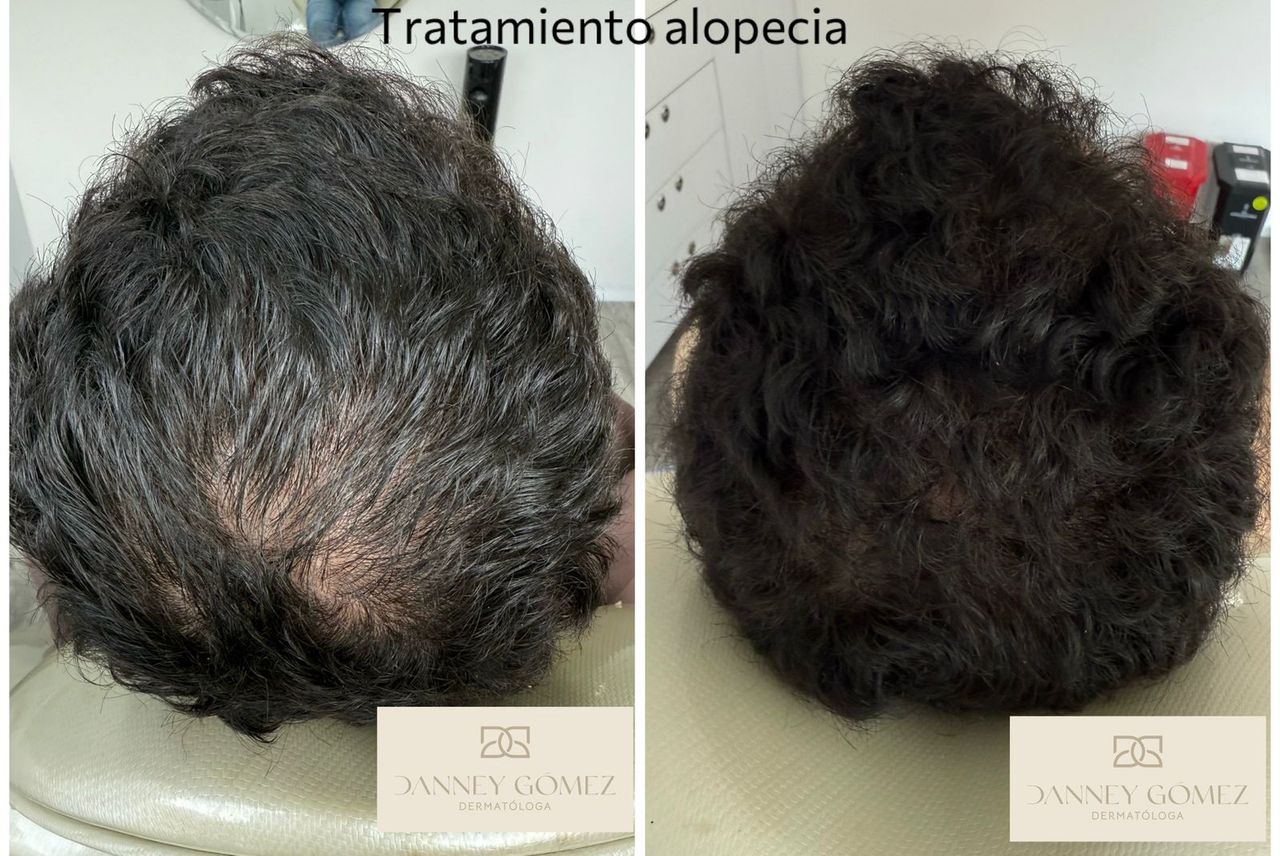 Danney Gomez Angulo-6