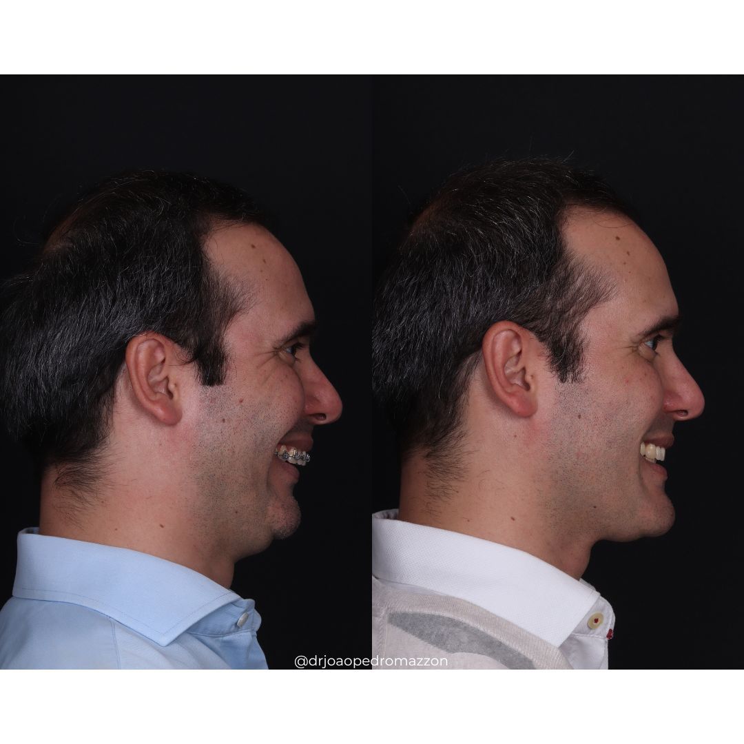 João Pedro Paulino Mazzon-51