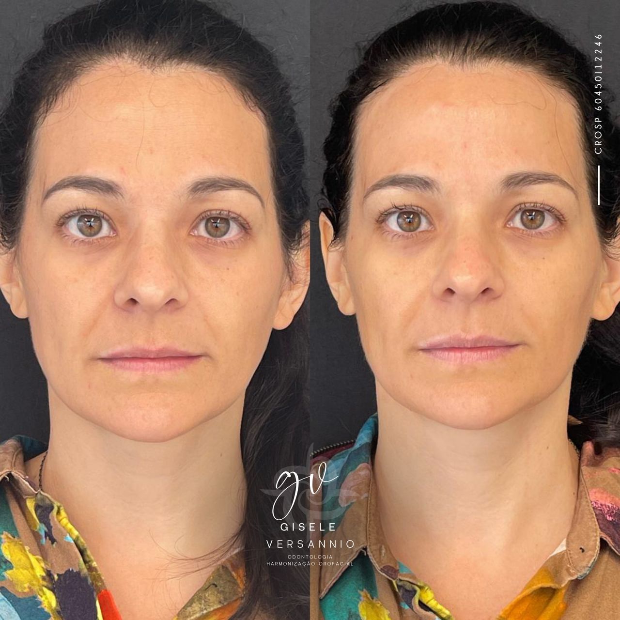 Gisele De Carvalho Versannio-44