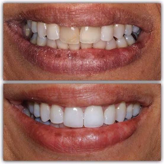 Rosemary Carneiro De Sá-49