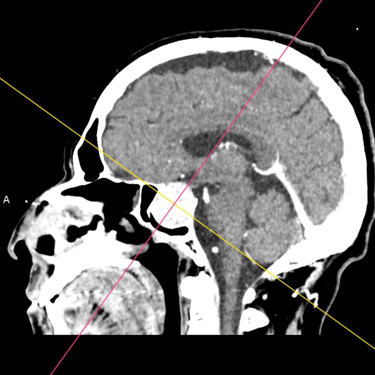 David Tafur Muñoz-1638