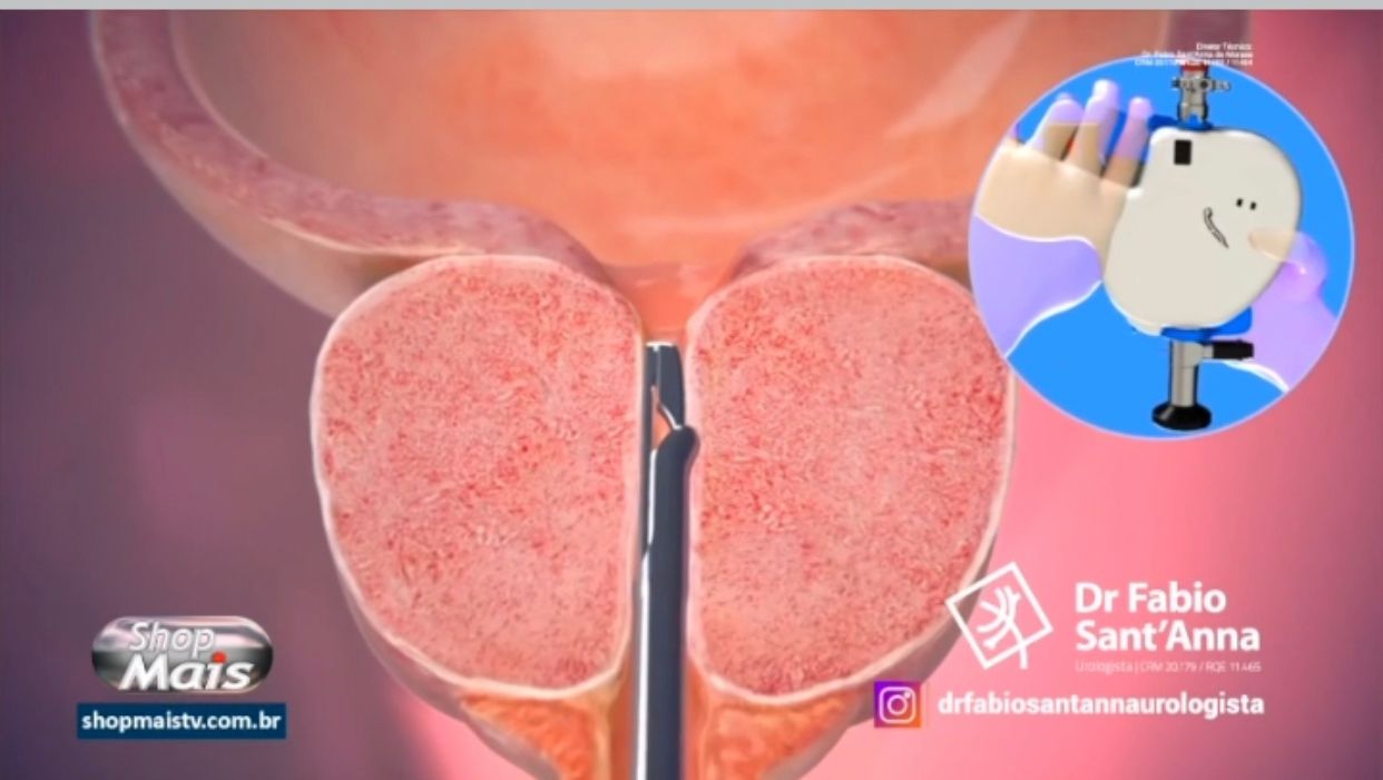 Fabio Sant Anna De Moraes-12