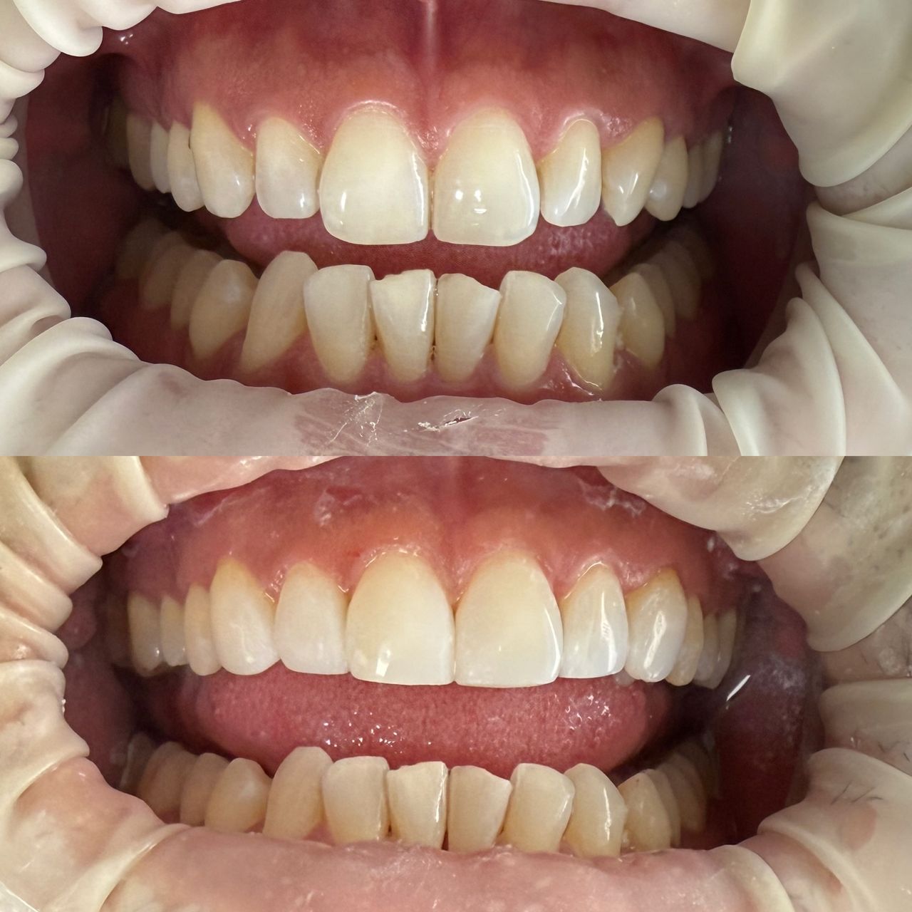 Juan Felipe Sossa Monsalve-3