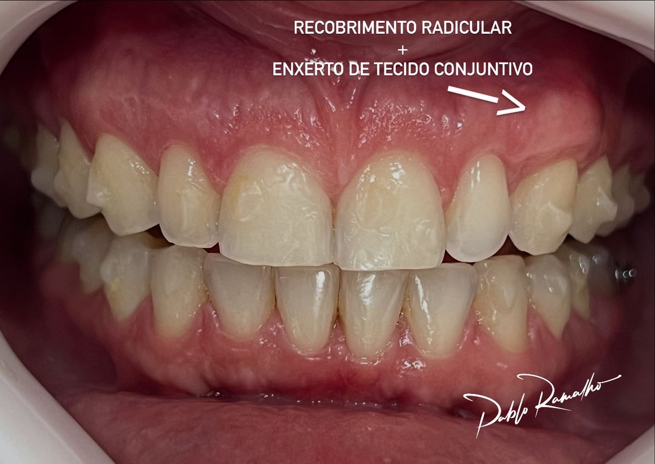 Pablo  Ramalho-20