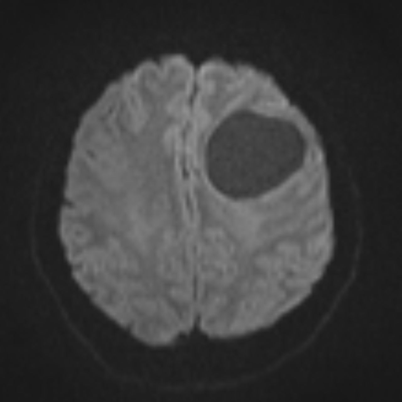 David Tafur Muñoz-2251