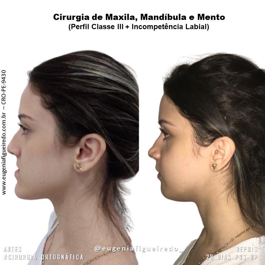 Eugênia Figueiredo-13